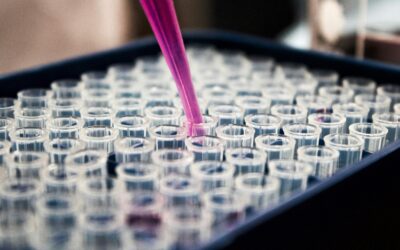 Baseline Labs for Bipolar Disorder